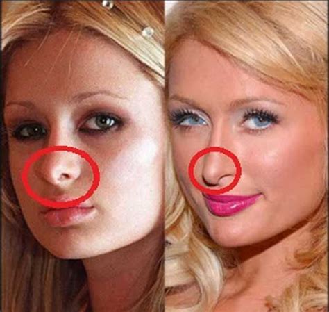 51 Most Popular Celebrity Nose Jobs: Before And After With Images